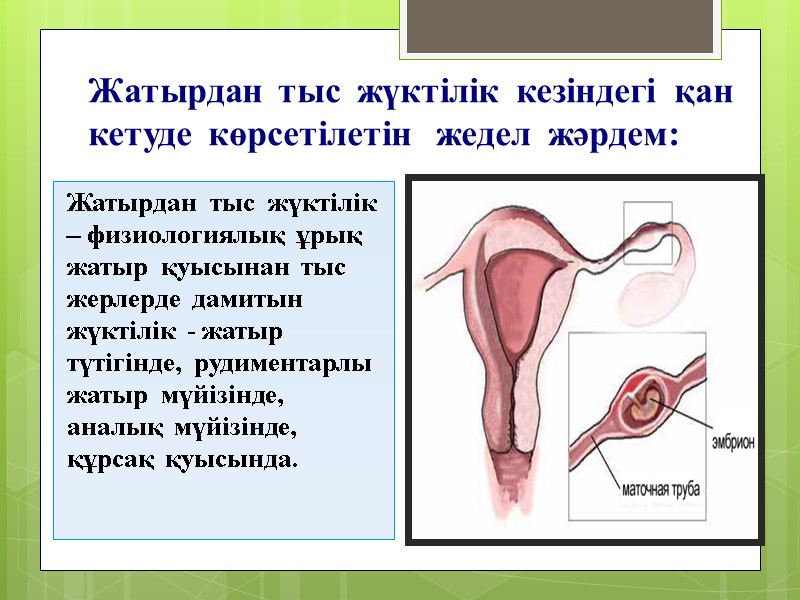 Жатырдан  тыс  жүктілік  кезіндегі  қан  кетуде  көрсетілетін 